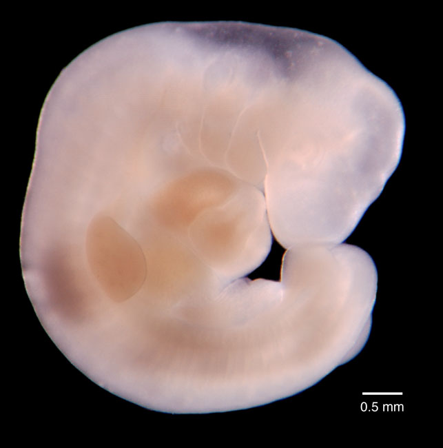 human embryo photograph