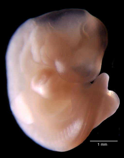 human embryo photograph