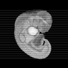 axial slice image map