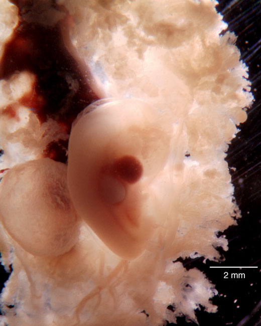 human embryo photograph