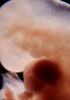 day 32 human embryo photograph