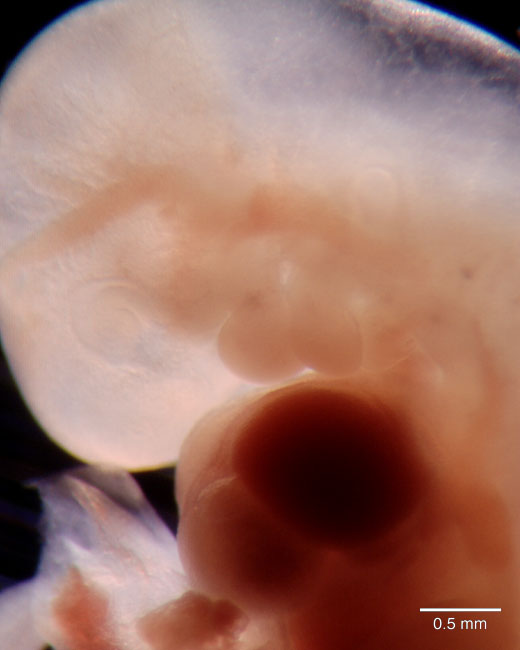 human embryo photograph