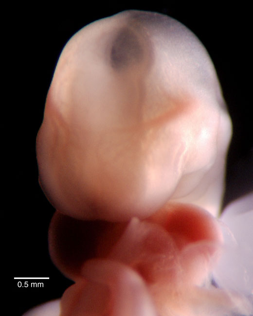 human embryo photograph