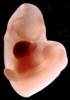 day 32 human embryo photograph