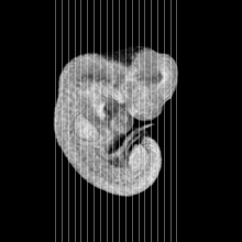 coronal slice image map
