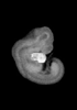 day 33 human embryo MRI animation