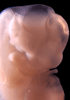 day 33 human embryo photograph