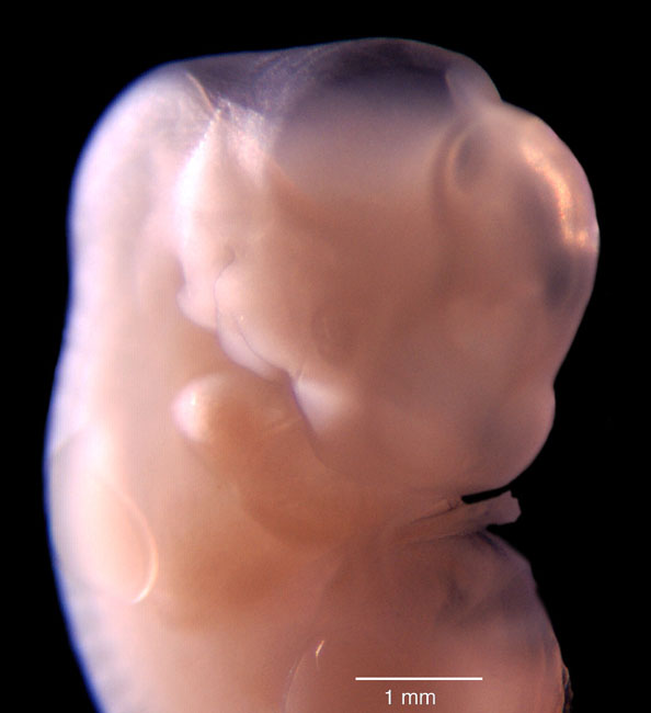 human embryo photograph