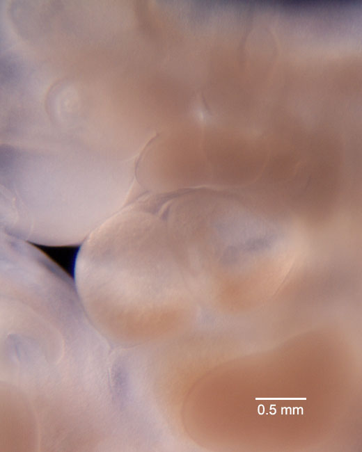 human embryo photograph