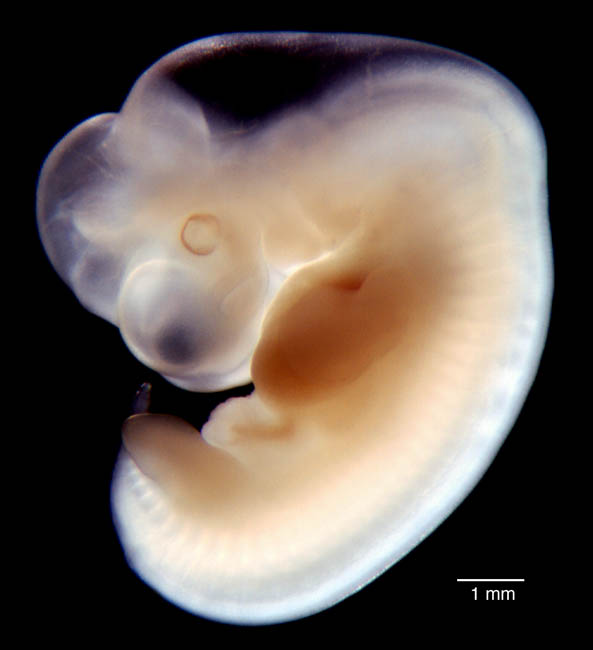 human embryo photograph