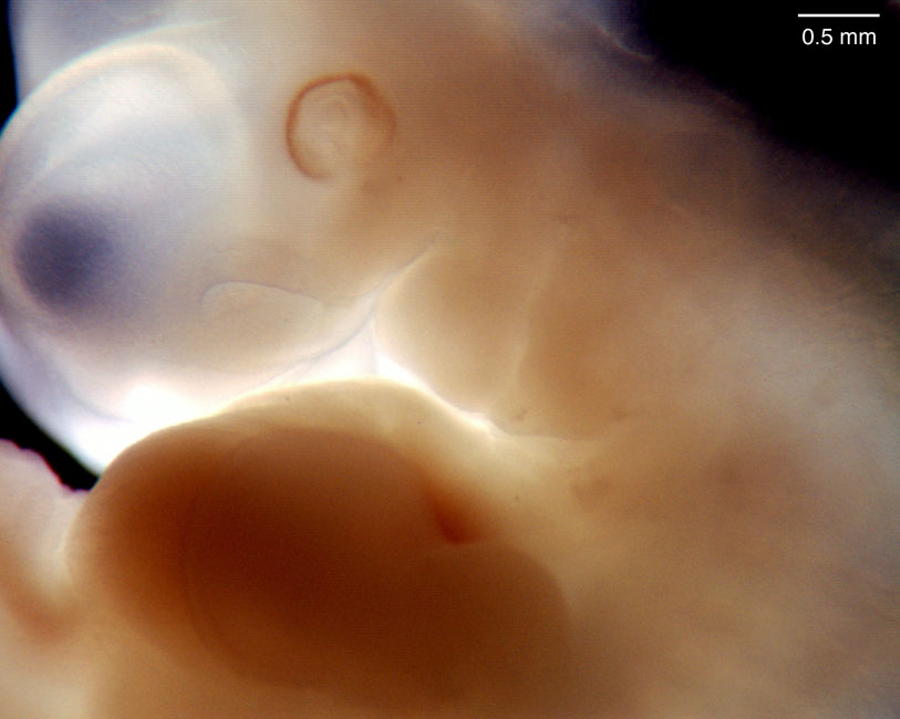 human embryo photograph