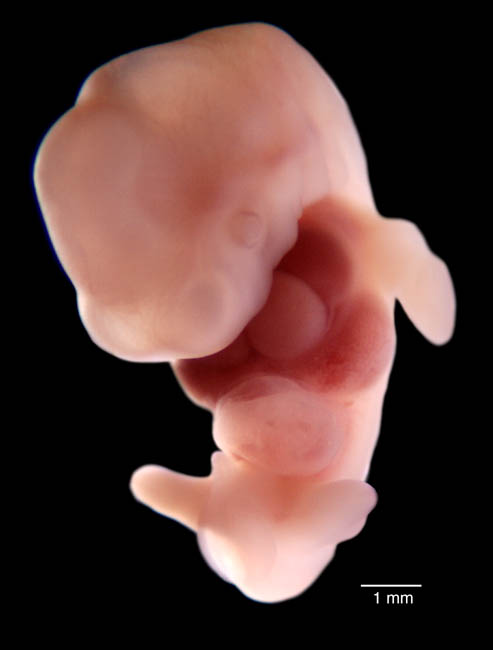 human embryo photograph