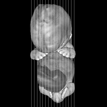 sagittal slice image map