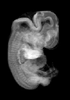 day 47 human embryo MRI animtaion