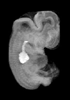 day 47 human embryo MRI animtaion