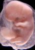 day 47 human embryo photograph