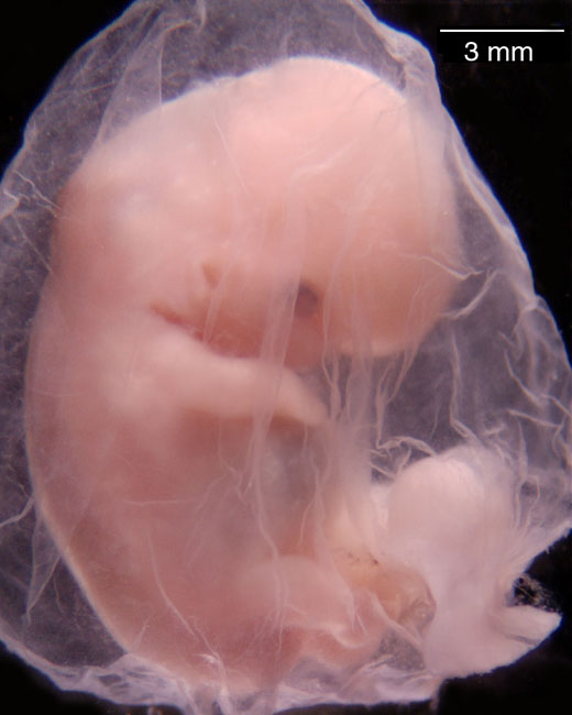 human embryo photograph