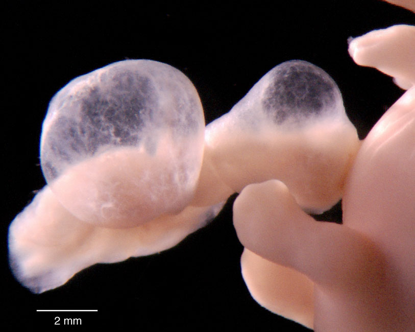 human embryo photograph