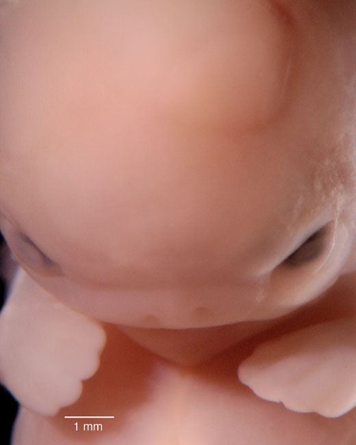 human embryo photograph