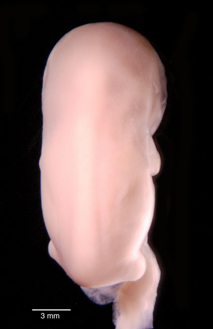 human embryo photograph