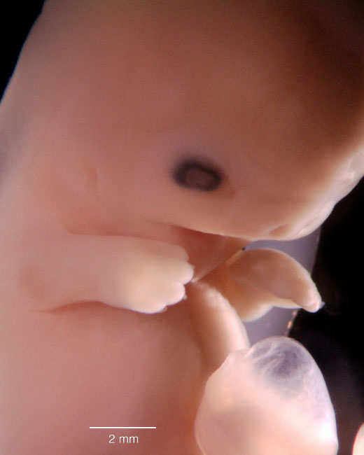 human embryo photograph