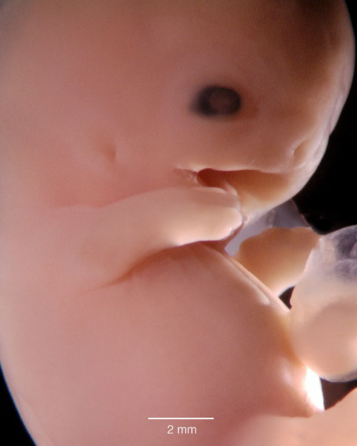 human embryo photograph