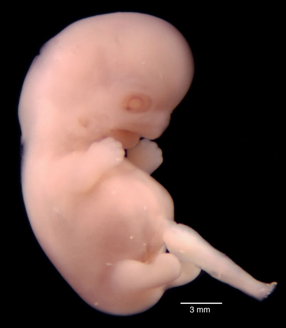 human embryo photograph