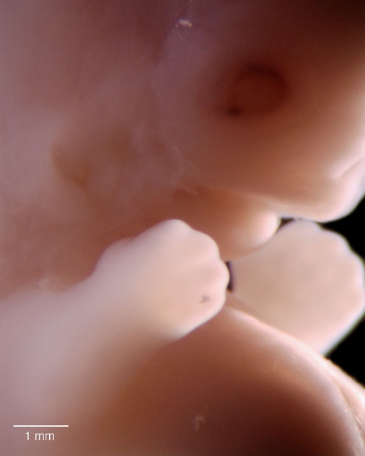human embryo photograph