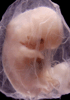 day 47 human embryo photograph