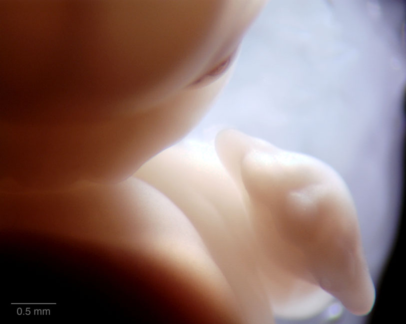 human embryo photograph