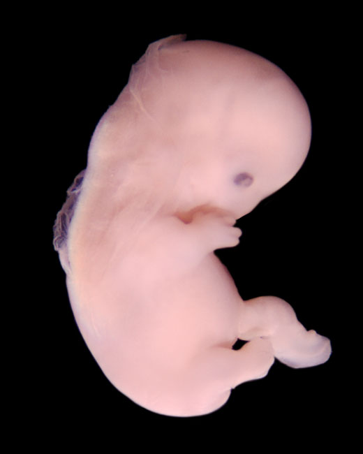 human embryo photograph